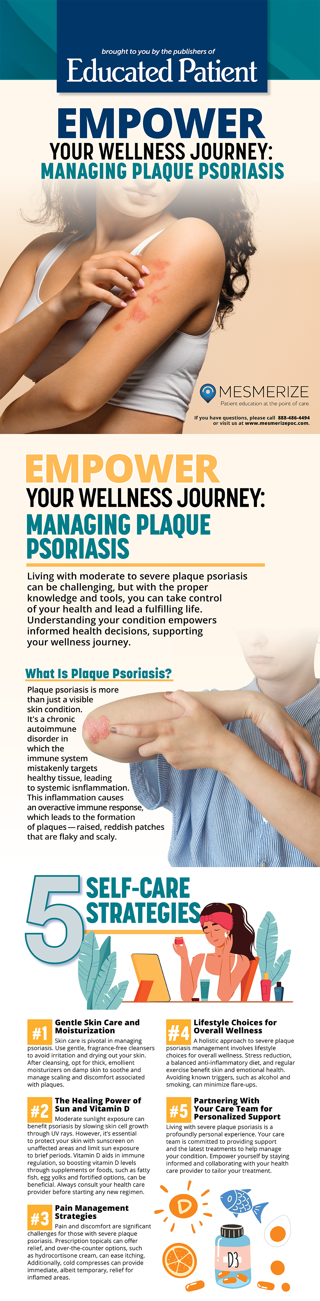 Managing Plaque Psoriasis